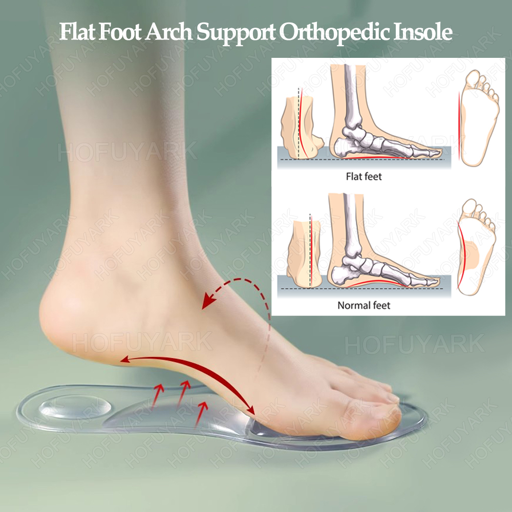 ซิลิโคนเจล Insoles ศัลยกรรมกระ - Women'S Shoes High Arch Support บทวิจารณ์และราคา
